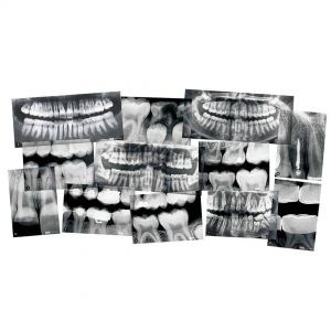 Roylco dental xrays included in kit.